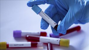 Pemkot Bandarlampung, Siapkan 5 Ribu Alat Rapid Test