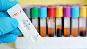 Pemkot Siap Lakukan Rapid Test Masal